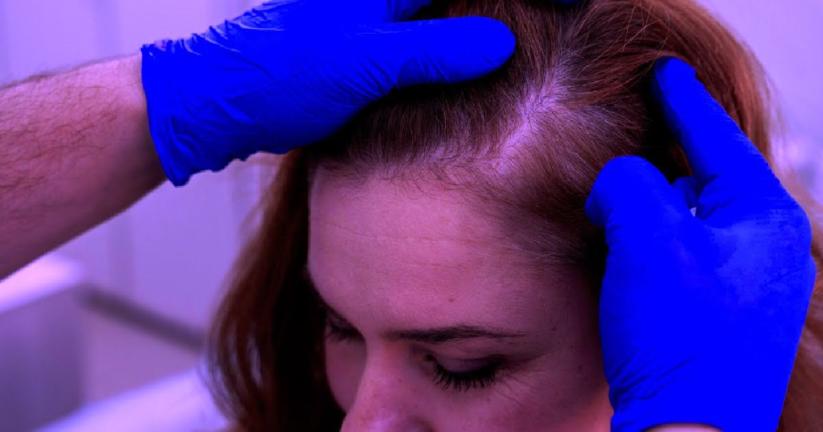 Learn the evidence-based research behind red light therapy benefits for hair. Discover how it can help treat hair loss and stimulate hair growth.